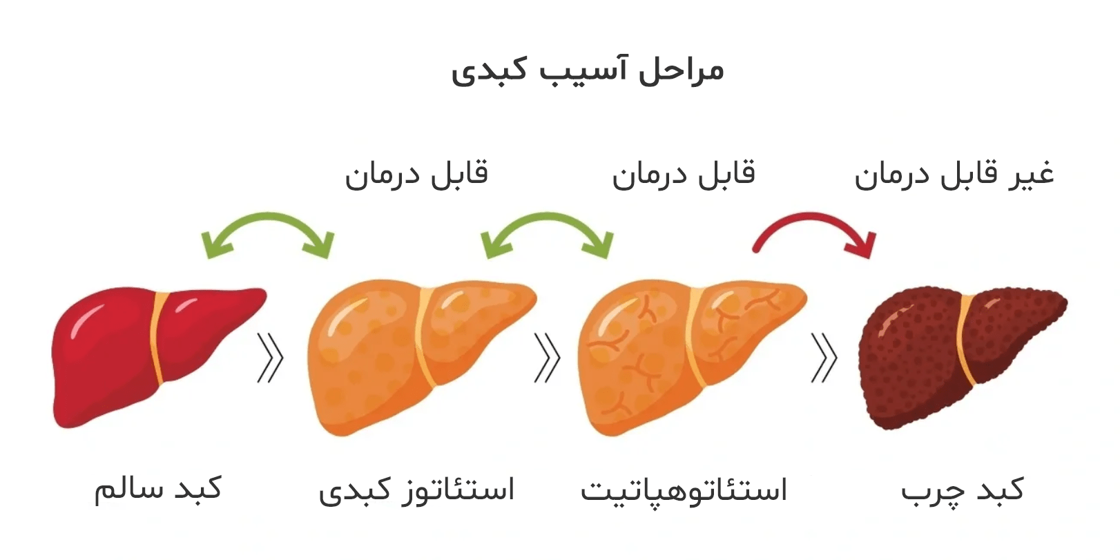 کبد چرب