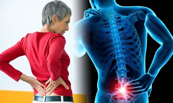 تغییر سبک زندگی برای کاهش کمردرد
